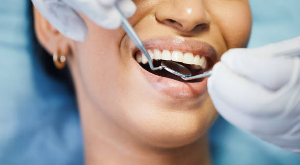 Best Dental Fillings (Composite and Amalgam)  in Kentfield, CA